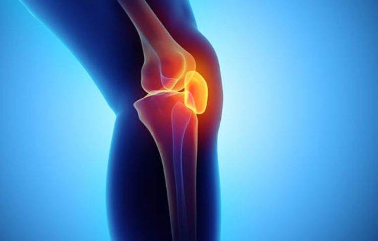 Liječenje artroze koljena kod kuće